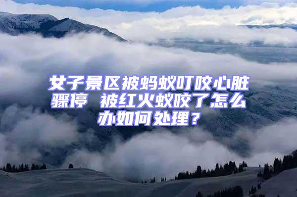 女子景區被螞蟻叮咬心臟驟停 被紅火蟻咬了怎么辦如何處理？